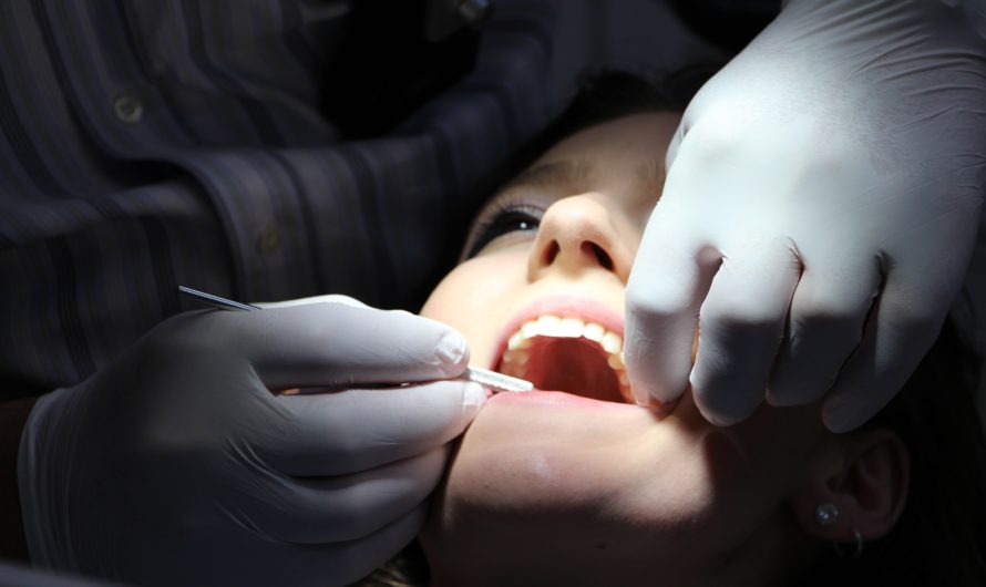 Abcès dentaire : quelle est la cause et comment le soigner ?