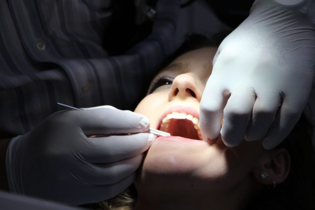 Tout savoir sur la cause et soin d'un abcès dentaire